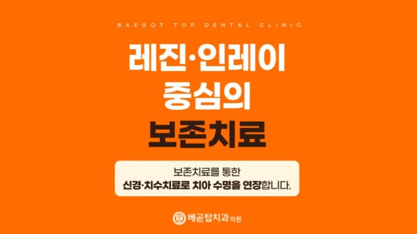 배너 3